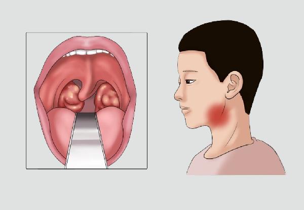 正确的眼保健操